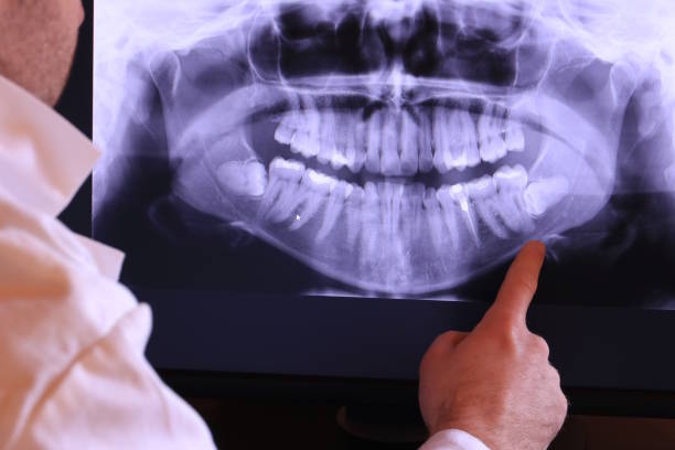 Best Broken or Chipped Tooth Repair in Four Corners, TX